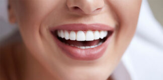 Jak dbać o licówki