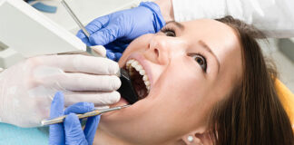 Jak poprawnie dbać o licówki