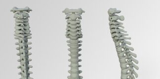 Czy nafta jest dobra na wypadanie włosów?